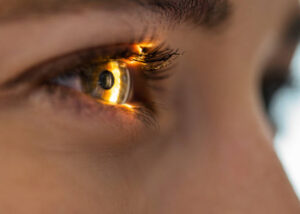 oculistica
